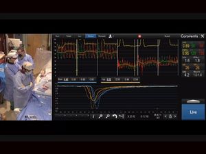 Device Helps Father Son Duo Make Quick Treatment Adjustment During Crt Live Case Crtonline